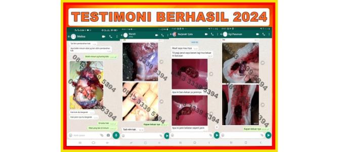 Obat Cytotec 400 mcg 081333395394 K24 Gorontalo Utara